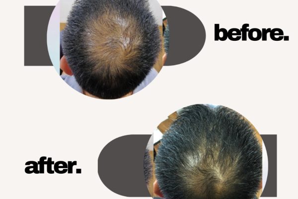 my-11134208-7qul5-lfrwkwcebyju72