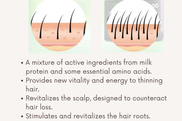 my-11134208-7qula-lfrwkwce4xpm4f